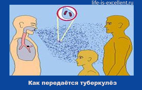 Как передается туберкулез