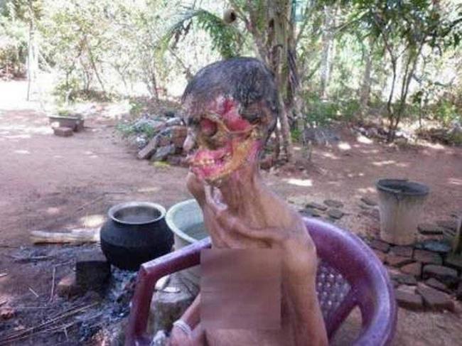 Вирусы, микробы и бактерии: в чем отличия?