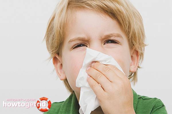 Причины белых выделений из носа и как их лечить