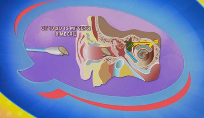 Ушная пробка у детей: особенности и удаление в домашних условиях