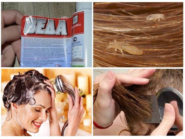 Шампуни веда и веда-2 – способ и инструкция по применению,чем отличается и какой лучше выбрать, цена и отзывы использования от вшей и гнид