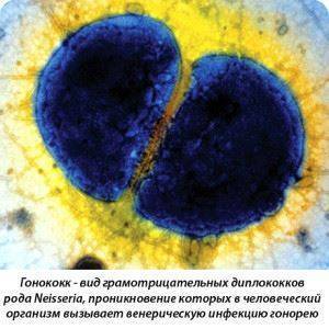 Посев мочи на бактерии