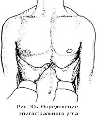 Деформация грудной клетки