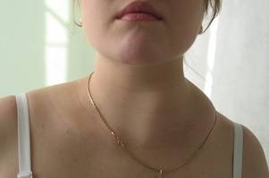 Бактерия синтия съедает всех. современное биооружие