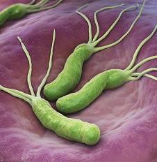 Симптомы заболеваний, ассоциированных с хеликобактер пилори. возможные последствия хеликобактериоза