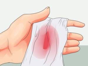 Причины крови в мокроте при отхаркивании - диагностика и лечение у детей и взрослых