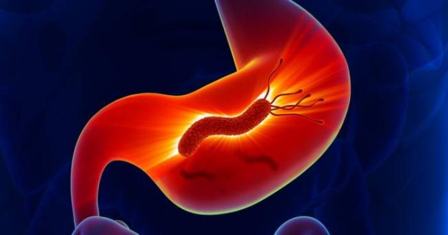 Схемы лечения гастрита с хеликобактер пилори