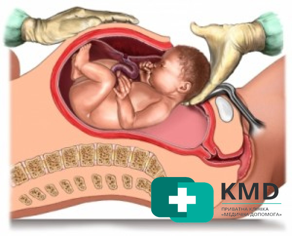 Геморрой – причины, о которых важно знать