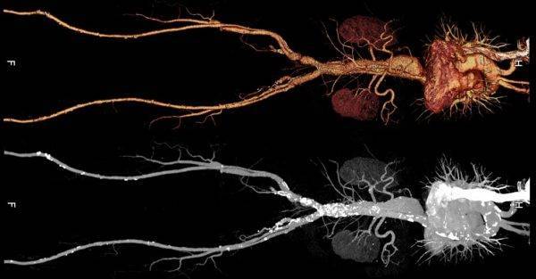 Что лучше узи или снимок позвоночника?