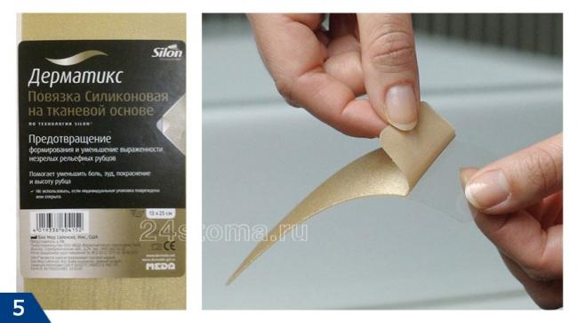 Дерматикс гель: инструкция по применению и для чего он нужен, цена, отзывы, аналоги