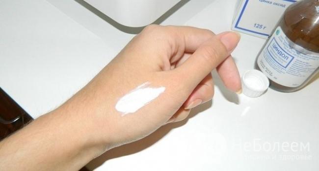 Циндол при ветрянке у детей: показания и инструкция