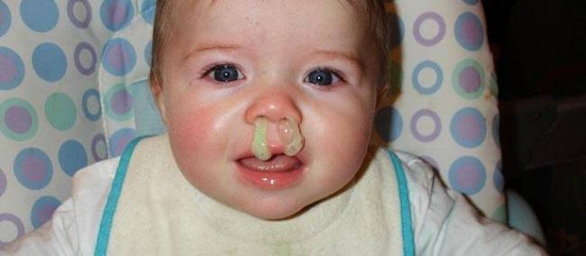 Желтая слизь из носа