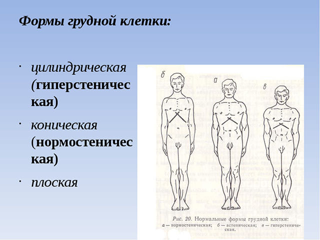 Деформация грудной клетки у ребенка