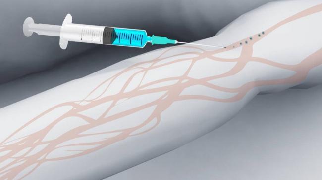 Кальция глюконат уколы