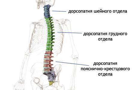 Дорсопатия пояснично-крестцового отдела позвоночника (поп): что это такое, лечение
