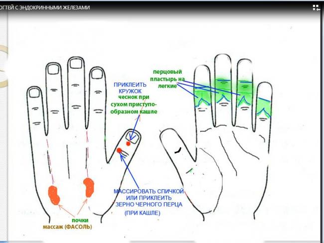 Перцовый пластырь при бронхите