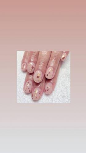 Ломкие ногти на руках: причины, лечение, витамины