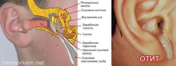Боль в горле слева при глотании