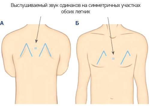 Бронхит. причины, симптомы и признаки. виды бронхитов и методы их диагностики