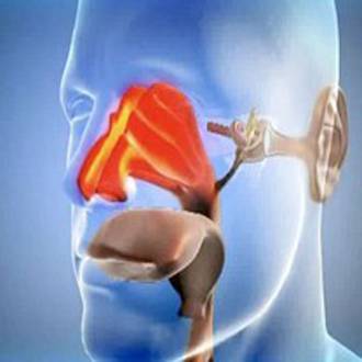 Хронический тонзиллит, лечение миндалин при хроническом тонзиллите без пробок хирургическим путем, казеозный детрит