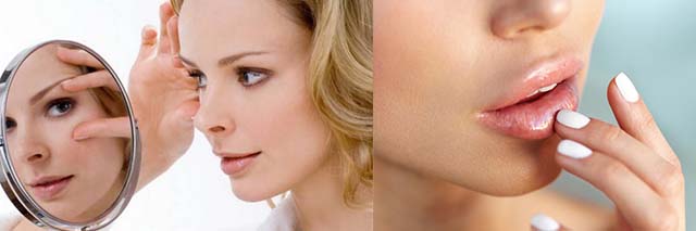 Ангионевротический отек: принципы диагностики и терапии