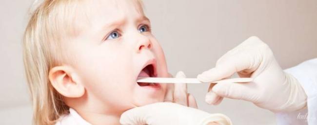 Воспаление миндалин в горле симптомы