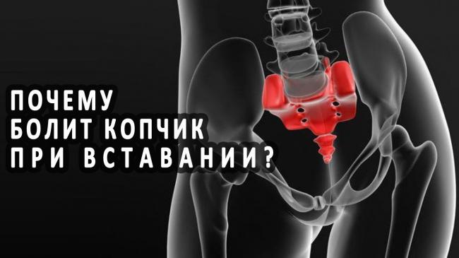 Что делать, если ноет и тянет копчик?
