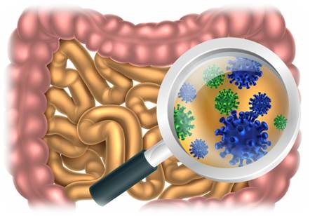 Признаки и виды бактериальной инфекции – диагностика и лечение заболеваний
