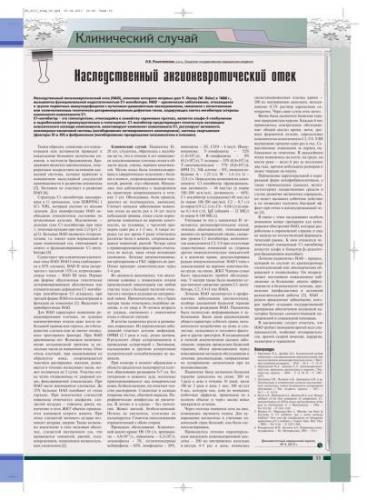 Причины и симптомы отека квинке. оказание первой неотложной медицинской помощи