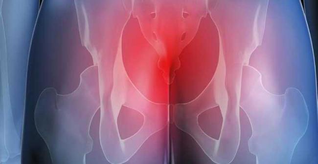 Болит копчик у мужчин и женщин: причины, диагностика и лечение