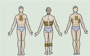 Перцовый пластырь при бронхите