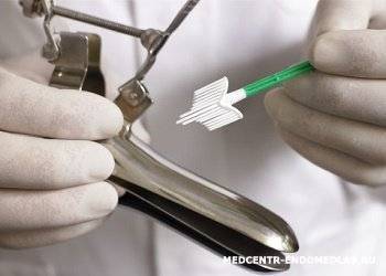 Мазок на флору у женщин. норма, таблица, расшифровка лейкоциты, эритроциты, кокки, при беременности