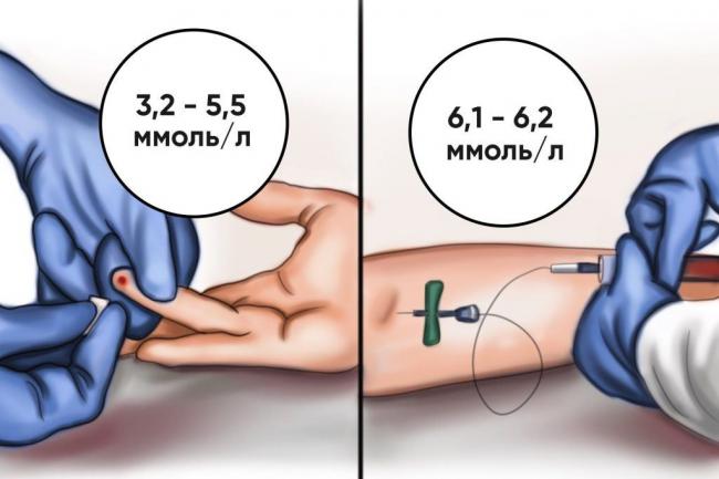 Норма сахара у женщин