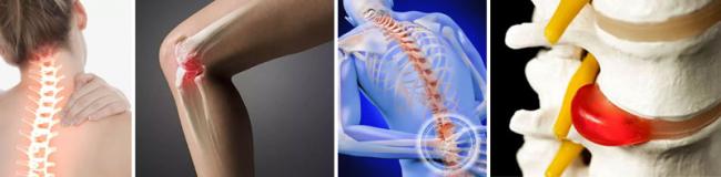 Нурофен гель: показания и противопоказания, аналоги