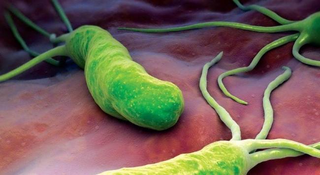 Почему лечение от хеликобактера пилори бессмысленно и вредно для здоровья. часть 2