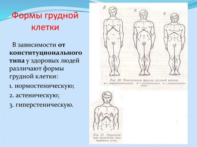 Воронкообразная грудная клетка - симптомы и лечение