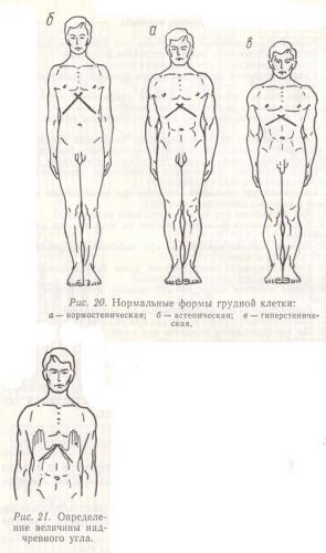 Деформация грудной клетки у ребенка: причины, лечение и разновидности