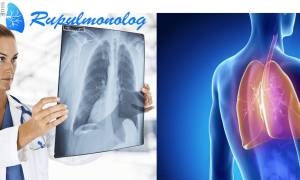 Пневмония. схема лечения у взрослого, антибиотики, народные средства, лекарства