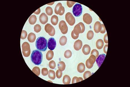 Основные методы лабораторного выявления бактерий