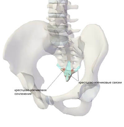 Кокцигодиния
