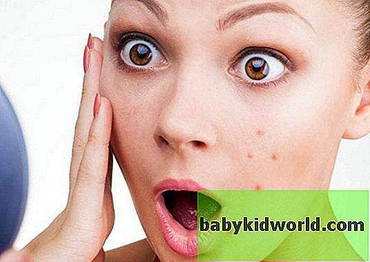 Радевит - инструкция по применению, отзывы, аналоги и формы выпуска мазь или крем лекарства для лечения экземы, псориаза, морщин у взрослых, детей и при беременности. Состав