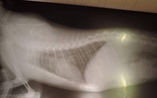 Мокрота с кровью: причины кровохарканья