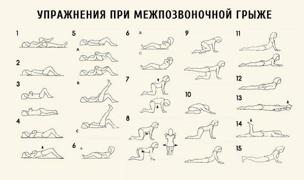 Растяжка позвоночника при грыже поясничного отдела в домашних условиях