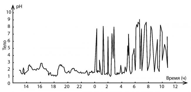 Дуоденогастральный рефлюкс: симптомы и лечение, причины, признаки, прогноз