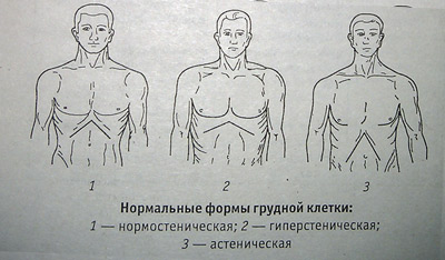 Лечение воронкообразной деформации грудной клетки у детей без операции: лфк, упражнения, массаж