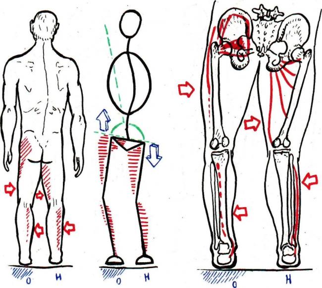 К какому врачу обратиться, если болит копчик?