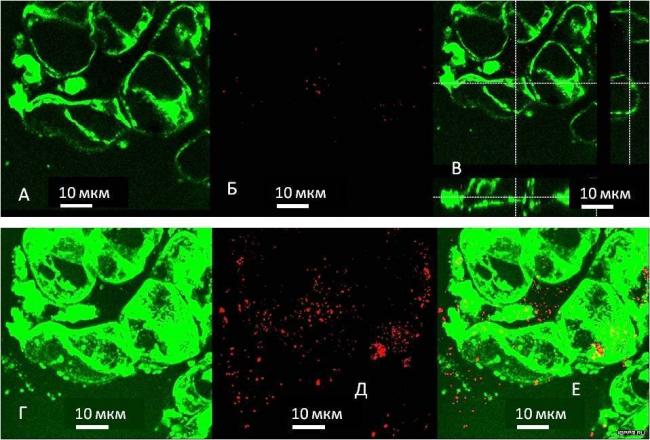 Значение и использование тинкториальных свойств микроорганизмов