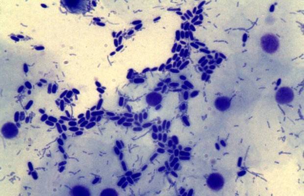 Что показывает мазок из зева на флору?