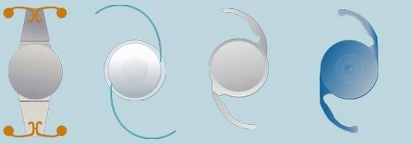 Мультифокальные торические иол