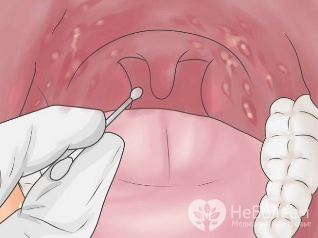 Каким должен быть идеальный пробиотик? - аптека "для человека"